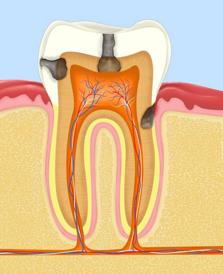 Sugars The Good and The Bad Smile Design Dental Group San Clemente