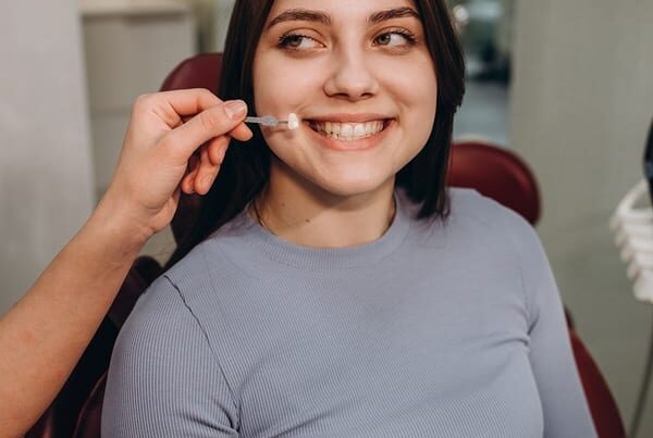 Veneers in San Clemente
