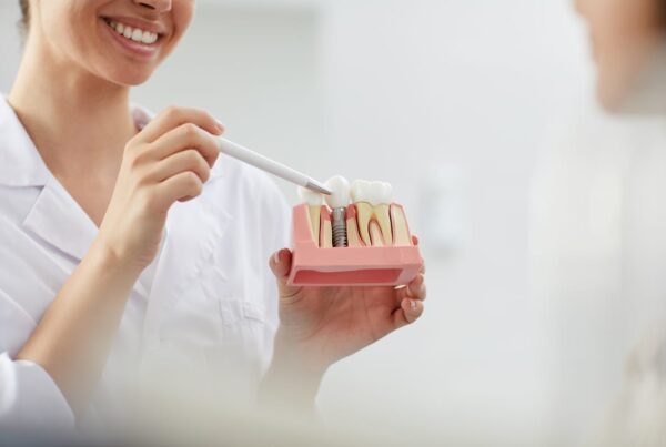 Dental Implants in San Clemente