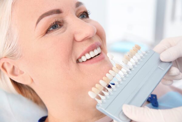 Veneers in San Clemente