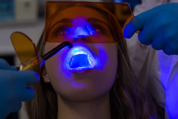 Teeth Whitening in San Clemente